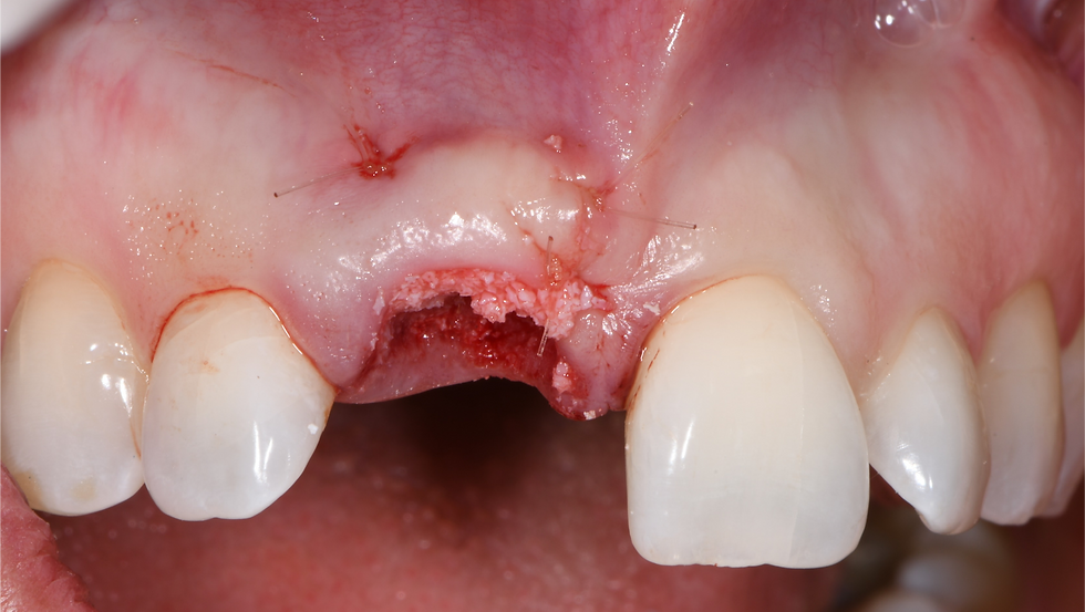 Image courtesy: Dr. Roberto Luongo