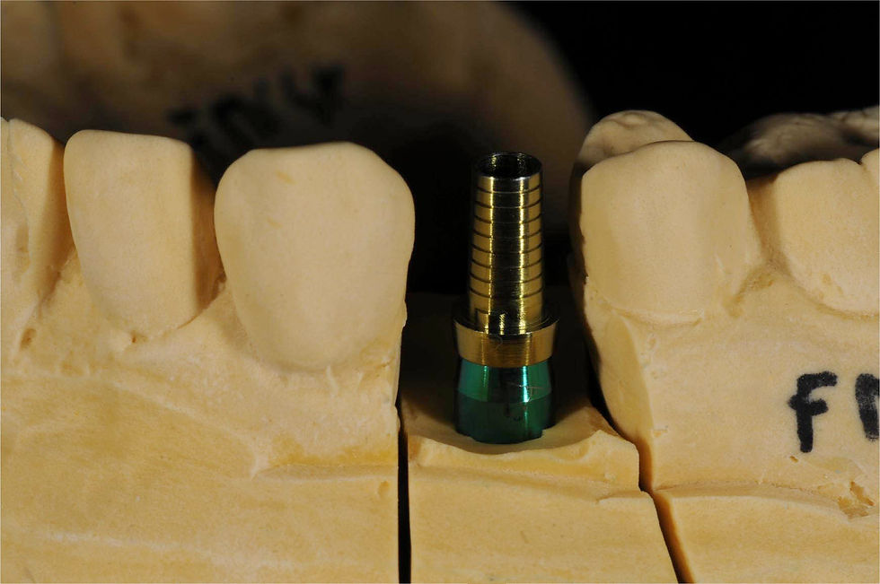 Image courtesy of: Dr. Costantino Vignato, Dr. Giuseppe Vignato.