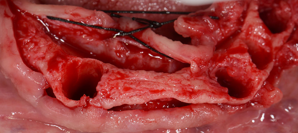 Image courtesy of: Gabriele Gori