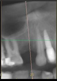 Image courtesy of: Dr. Guillermo Cabanes Gumbau