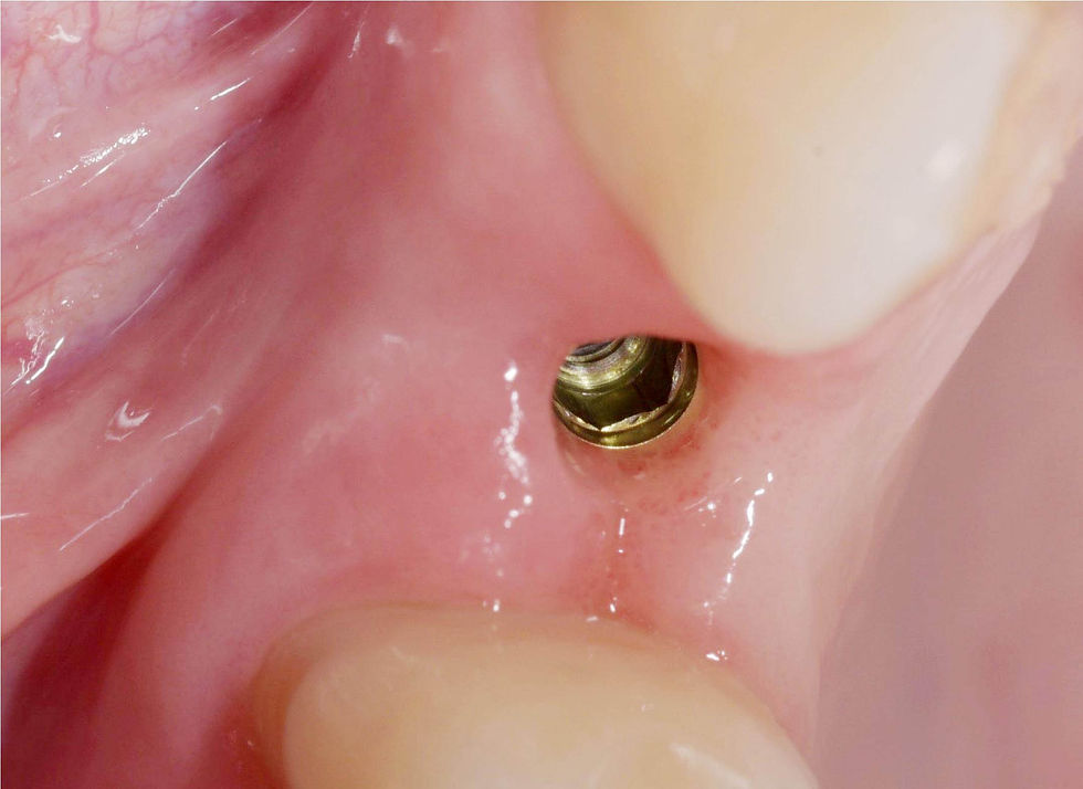 Image courtesy of: Dr. Costantino Vignato, Dr. Giuseppe Vignato