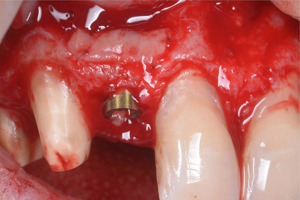 Image courtesy of: Dr. Giuseppe Pellitteri