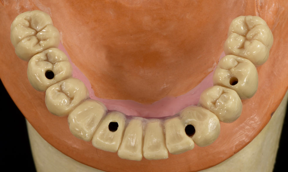 Image courtesy of: Gabriele Gori