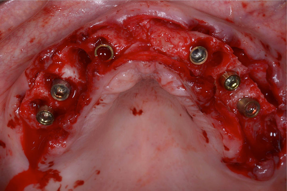 Image courtesy of: Dr. Giuseppe Pellitteri