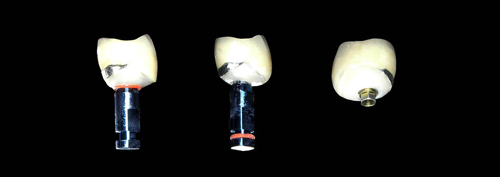 Image courtesy of: Dr. Guillermo Cabanes Gumbau