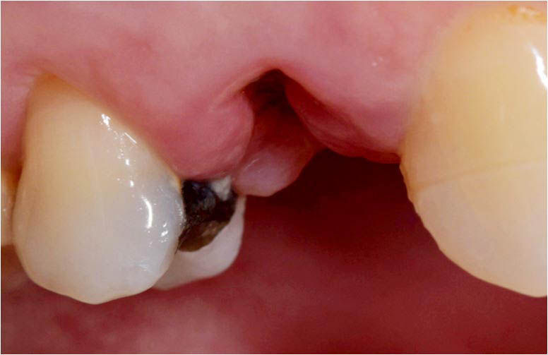 Image courtesy of: Dr. Costantino Vignato, Dr. Giuseppe Vignato