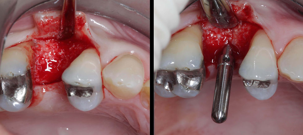 Foto per gentile concessione: Dott. Davide Guglielmi, Dott. Roberto Castellano.