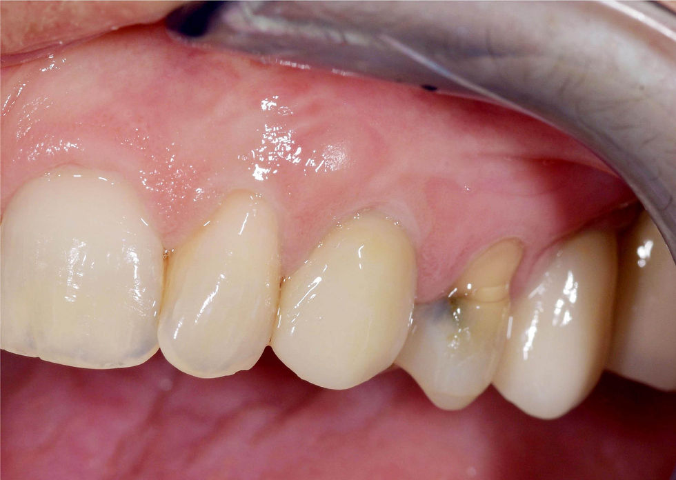 Image courtesy of: Dr. Costantino Vignato, Dr. Giuseppe Vignato