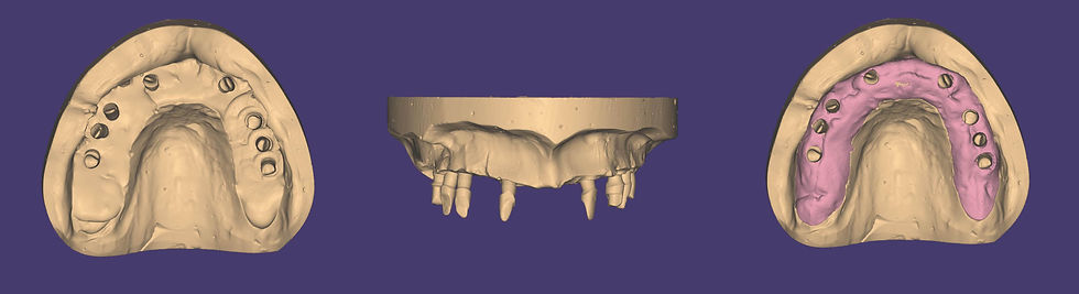 Image courtesy of: Prof. Antonio Barone, Dr. Fortunato Alfonsi