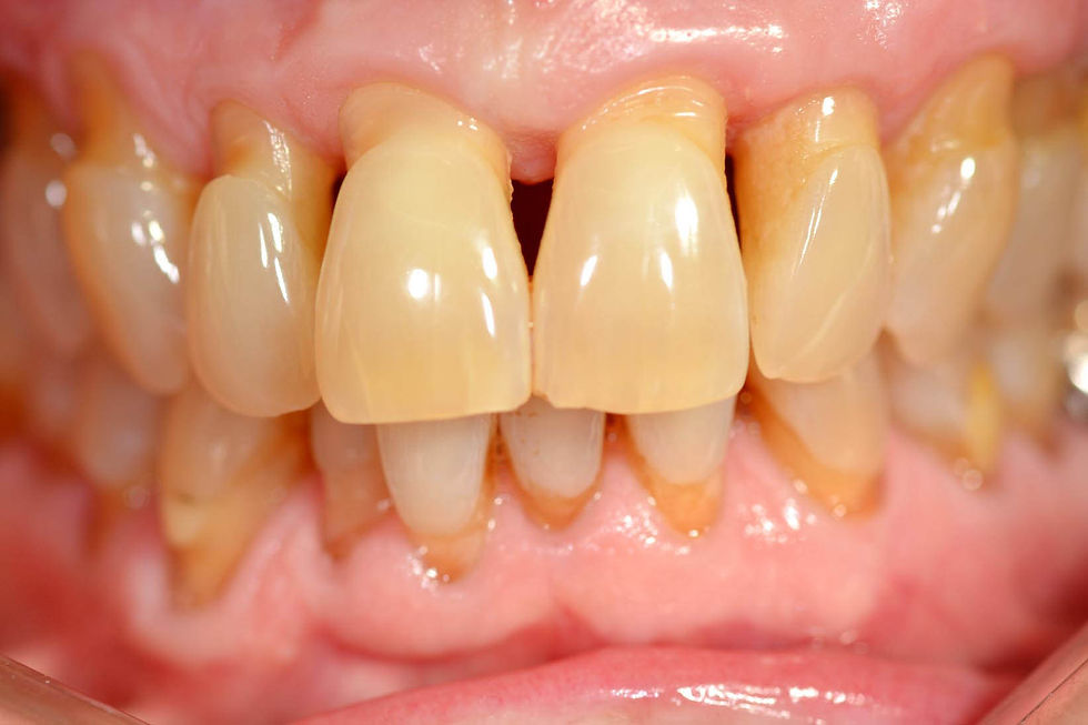 Image courtesy of: Prof. Antonio Barone, Dr. Fortunato Alfonsi