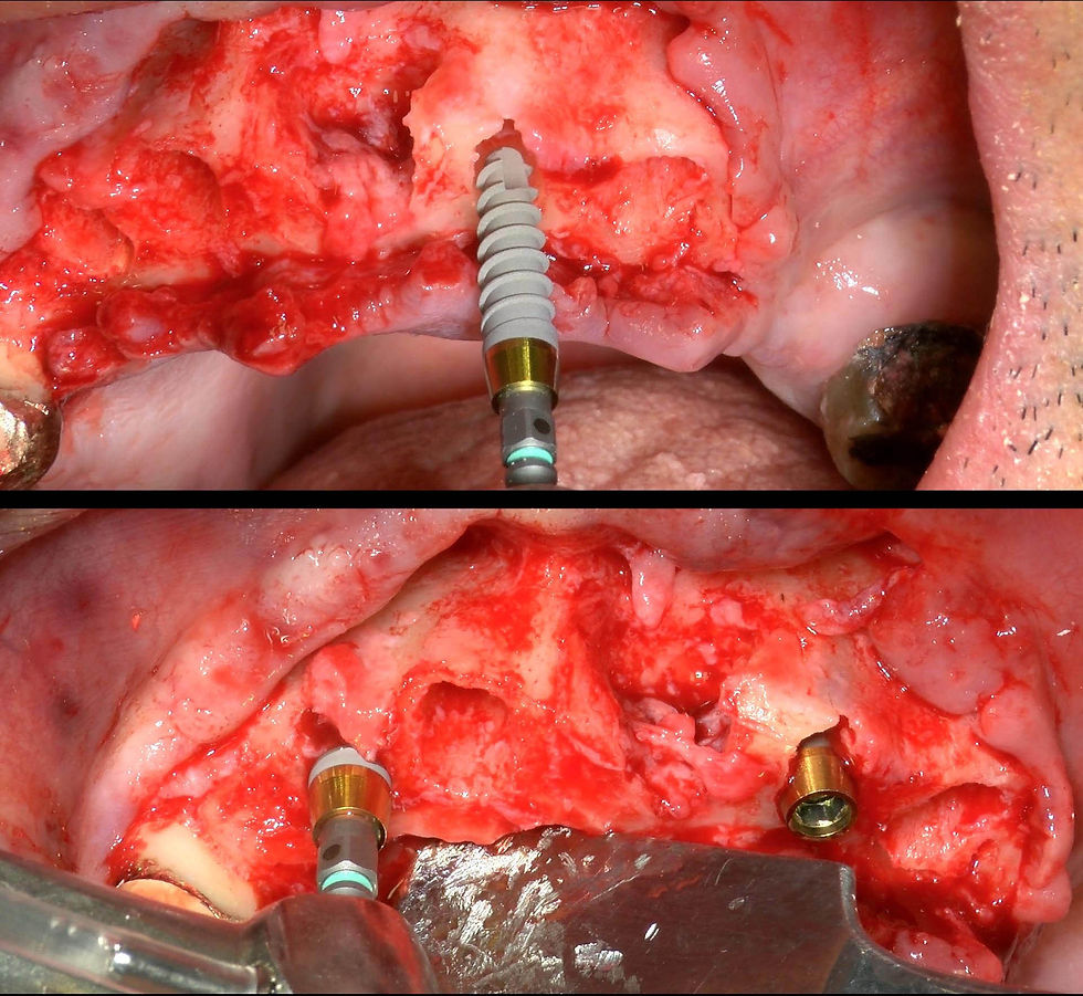 Image courtesy of: Dr. Leonello Biscaro