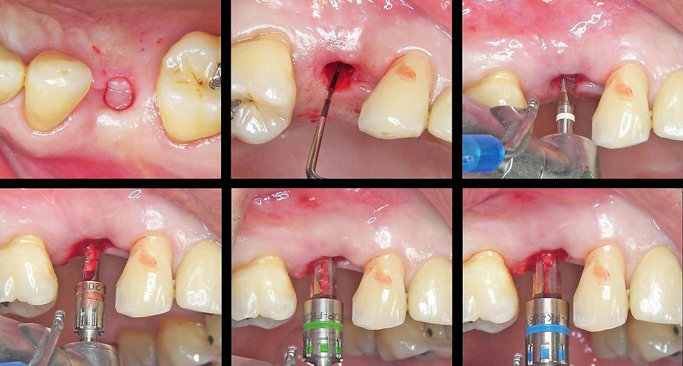 Image courtesy of: Dr. Guillermo Cabanes Gumbau