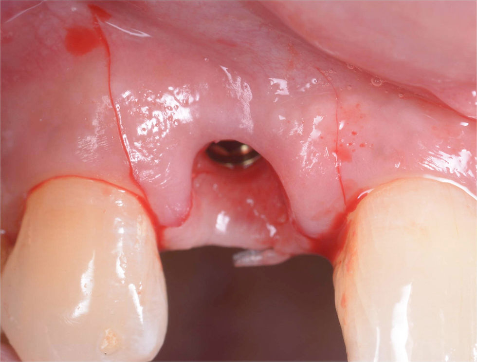 Image courtesy of: Dr. Giuseppe Pellitteri