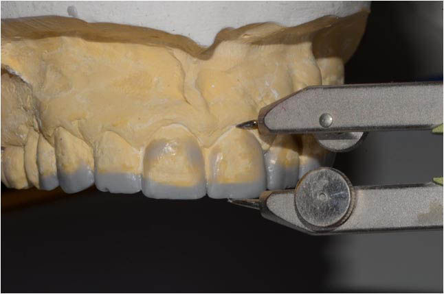 Image courtesy of: Dr. Leonello Biscaro