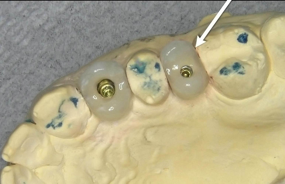 Image courtesy of: Dr. Guillermo Cabanes Gumbau