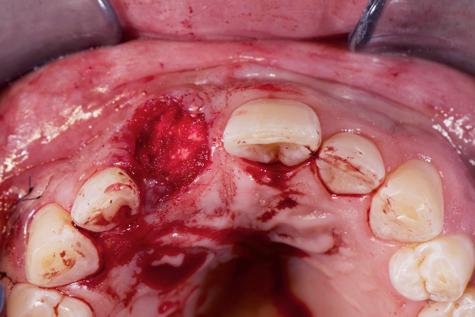 Image courtesy of: dr. Luigi Canullo