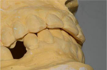 Image courtesy of: Dr. Leonello Biscaro