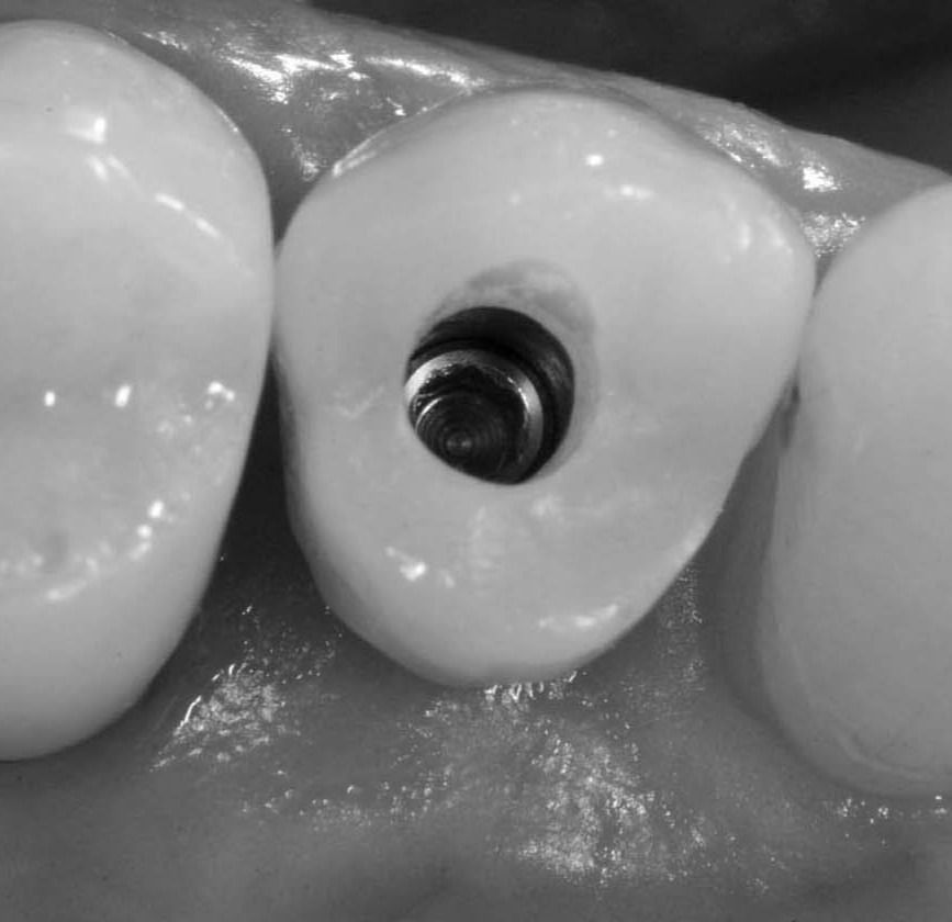 Image courtesy of: Dr. Costantino Vignato, Dr. Giuseppe Vignato.