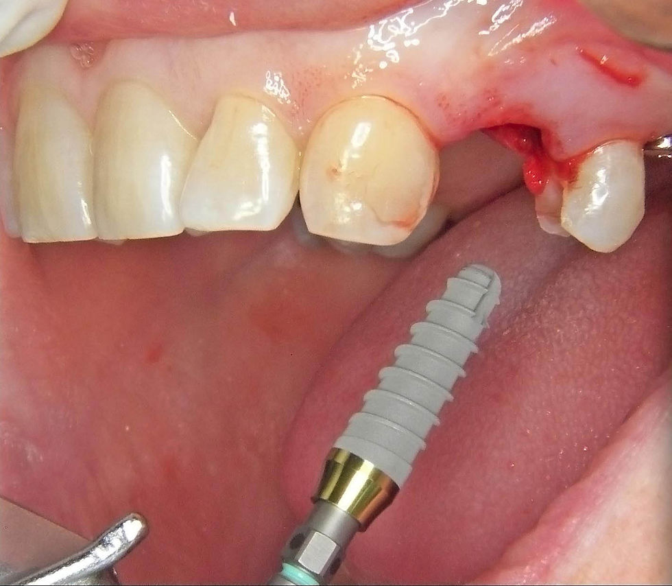 Image courtesy of: Dr. Guillermo Cabanes Gumbau