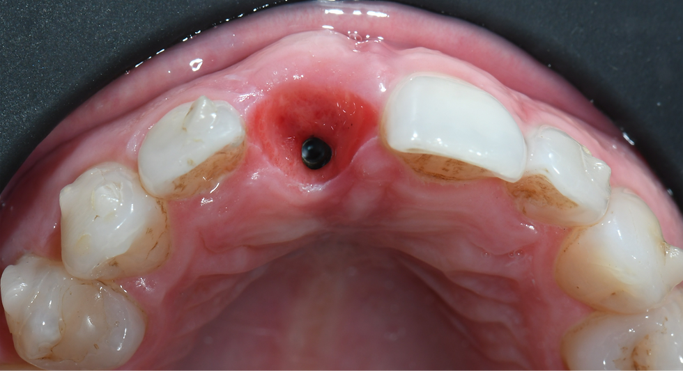 Image courtesy: Dr. Roberto Luongo