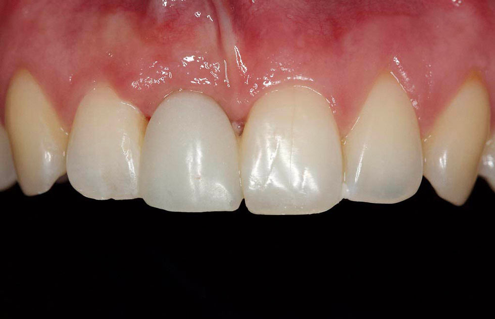 Image courtesy of: Prof. Berta GarcÃa Mira