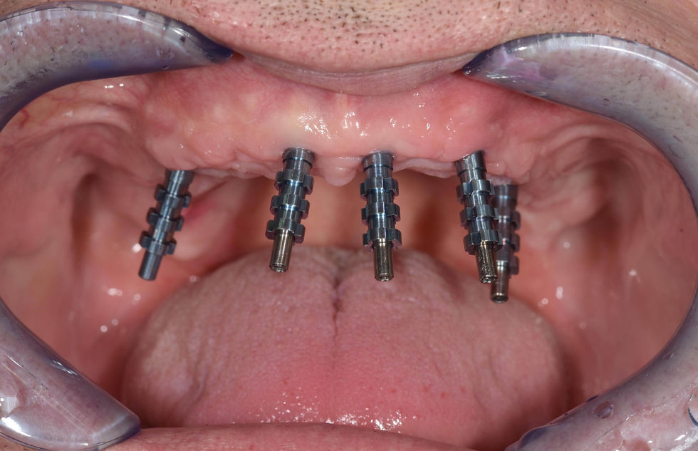 Image courtesy of: Dr. Costantino Vignato, Dr. Giuseppe Vignato