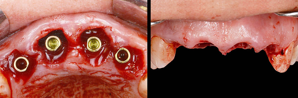 Image courtesy of: Dr. Xavier Vela Nebot, Dr. Xavier RodrÃguez Ciurana