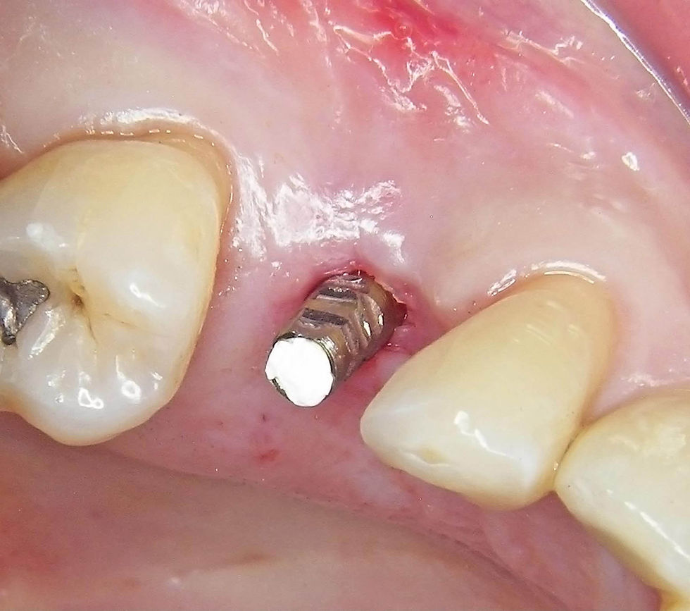 Image courtesy of: Dr. Guillermo Cabanes Gumbau