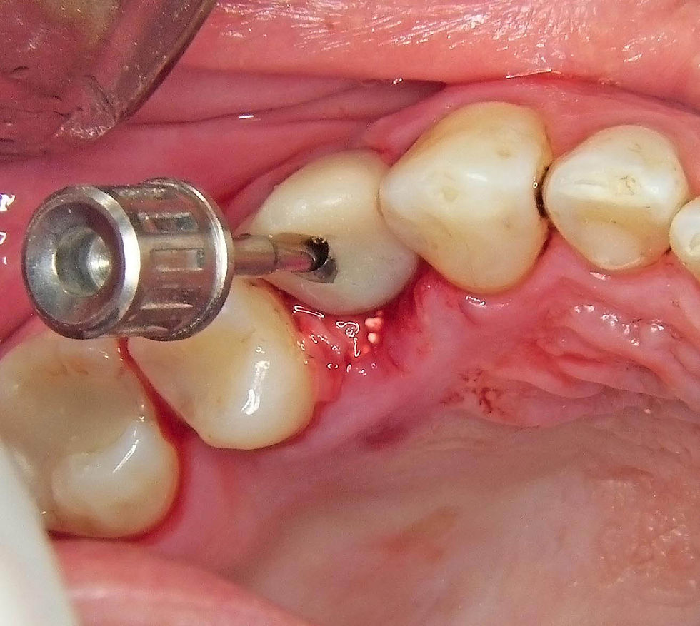 Image courtesy of: Dr. Guillermo Cabanes Gumbau