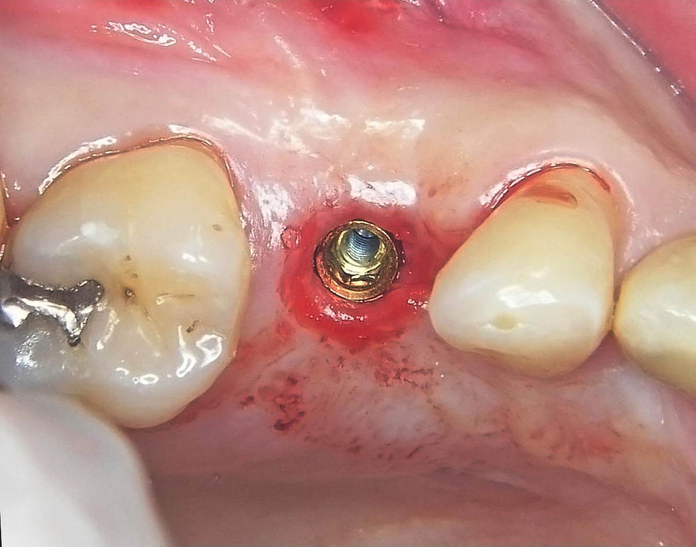 Image courtesy of: Dr. Guillermo Cabanes Gumbau