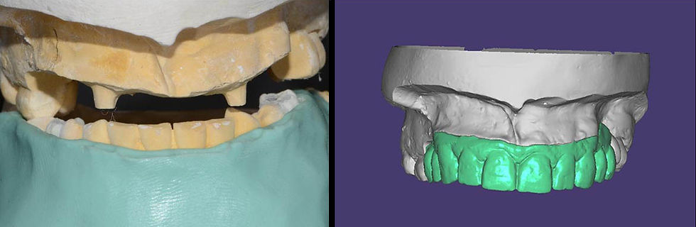 Image courtesy of: Dr. Leonello Biscaro