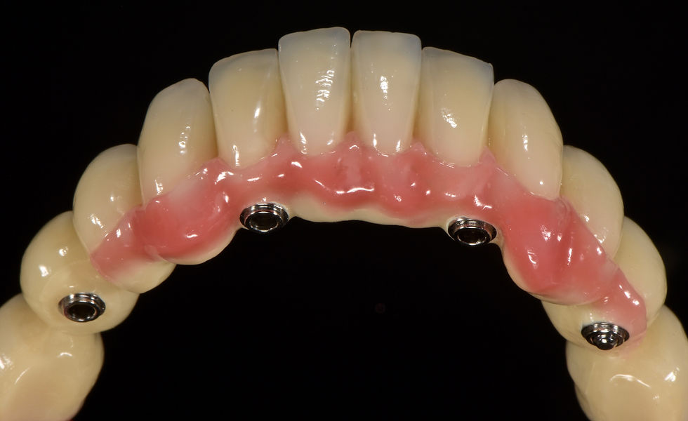 Image courtesy of: Gabriele Gori