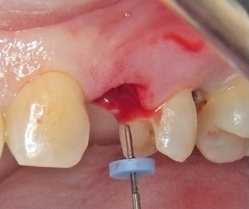 Image courtesy of: Dr. Guillermo Cabanes Gumbau