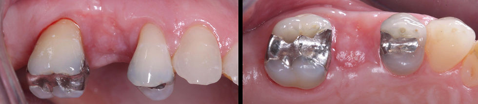 Foto per gentile concessione: Dott. Davide Guglielmi, Dott. Roberto Castellano.