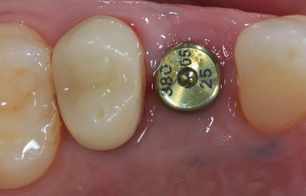 Image courtesy of: Dr. Costantino Vignato, Dr. Giuseppe Vignato.