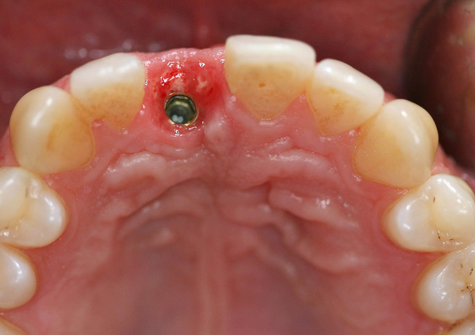 Image courtesy of: Prof. Berta GarcÃa Mira