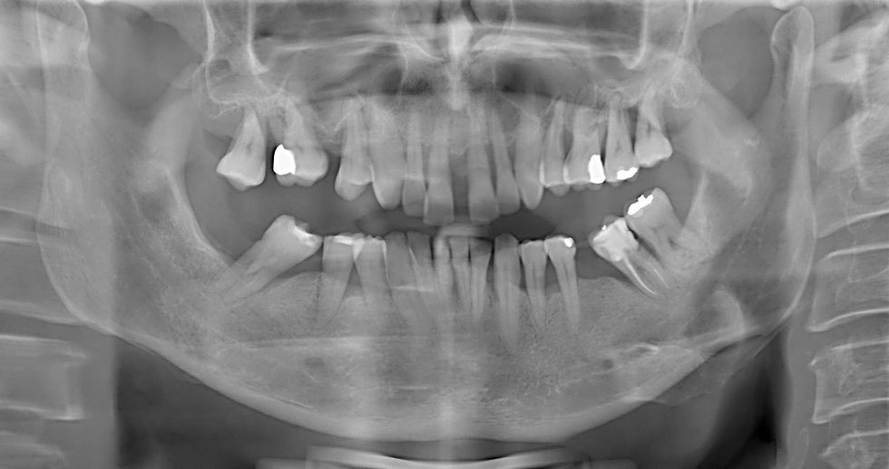 Image courtesy of: Dr. Costantino Vignato, Dr. Giuseppe Vignato