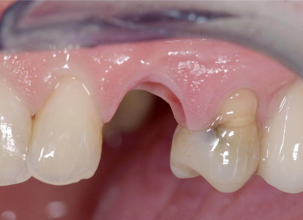 Image courtesy of: Dr. Costantino Vignato, Dr. Giuseppe Vignato