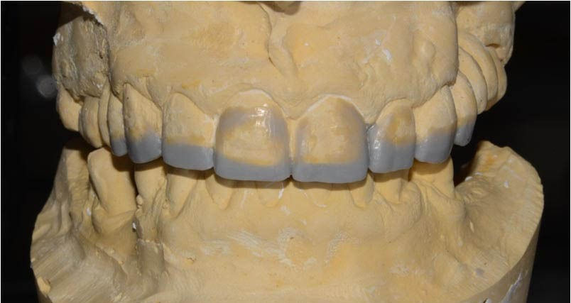 Image courtesy of: Dr. Leonello Biscaro