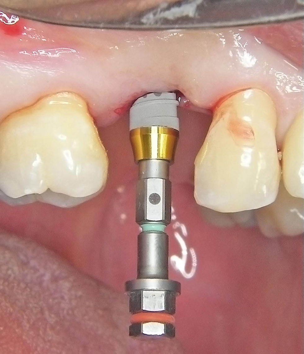 Image courtesy of: Dr. Guillermo Cabanes Gumbau