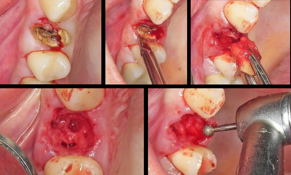 Image courtesy of: Dr. Guillermo Cabanes Gumbau