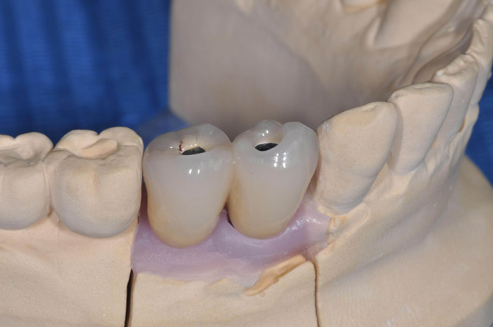 Image courtesy of: Prof. Marco Gargari, Dr. Federico Guzzo