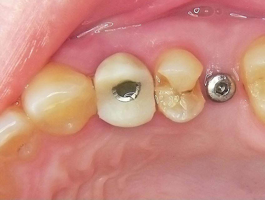 Image courtesy of: Dr. Guillermo Cabanes Gumbau