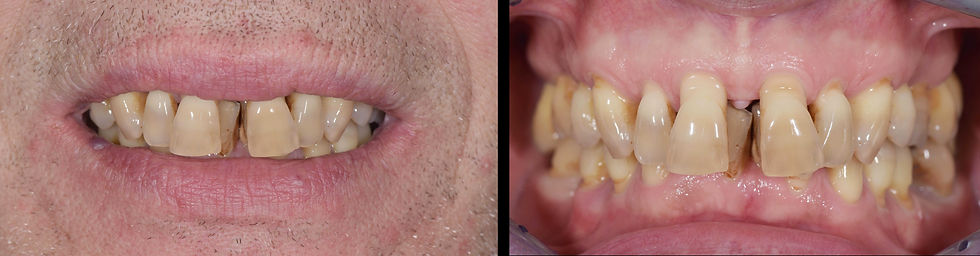 Image courtesy of: Dr. Costantino Vignato, Dr. Giuseppe Vignato