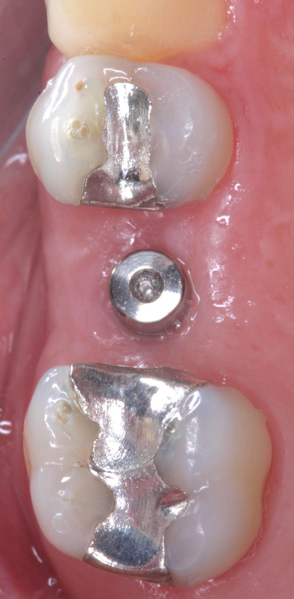 Foto per gentile concessione: Dott. Davide Guglielmi, Dott. Roberto Castellano.