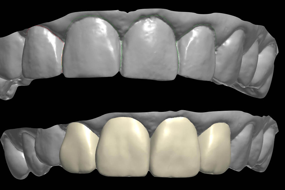 Image courtesy of: Dr. Xavier Vela Nebot, Dr. Xavier RodrÃguez Ciurana
