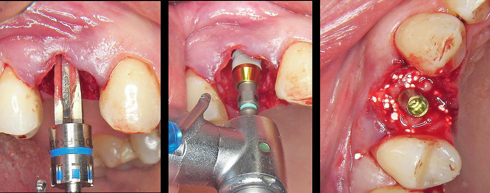 Image courtesy of: Dr. Guillermo Cabanes Gumbau