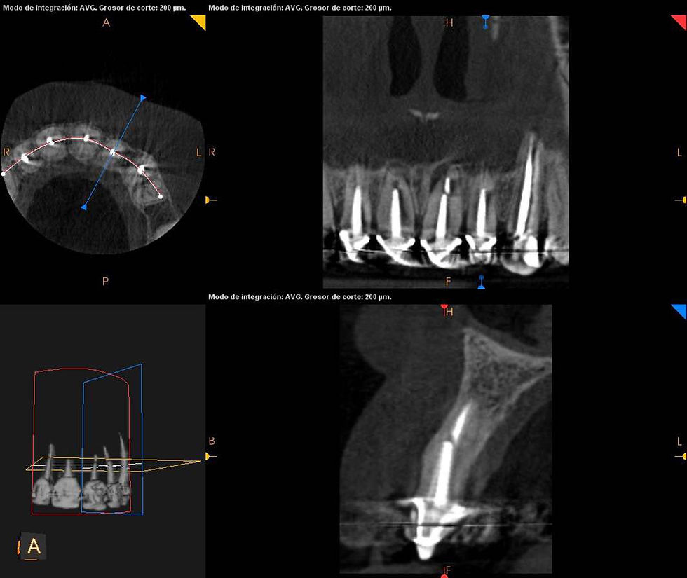 Image courtesy of: Dr. Xavier Vela Nebot, Dr. Xavier RodrÃguez Ciurana