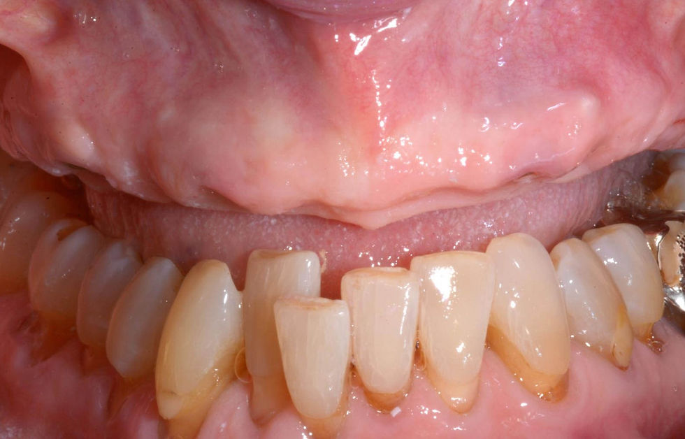 Image courtesy of: Prof. Antonio Barone, Dr. Fortunato Alfonsi