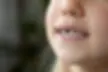 Child loose in front tooth